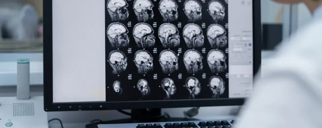 Консультация врача-диагноста в Израиле — клиника Сураски (Ихилов)